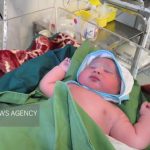 کودک یک‌ساله کاشانی از مرگ حتمی نجات یافت_69ff8d2ee2075.jpeg